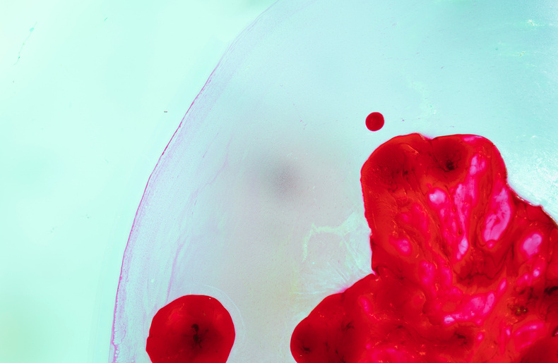 Blood Cancer Awareness Month 2025