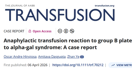 Anaphylactic transfusion reaction to group B platelets.png